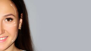 Polynucléotides-autour-des-yeux-Rouen-dr-pellerin Améliorer l’apparence des cicatrices d’acné à Rouen